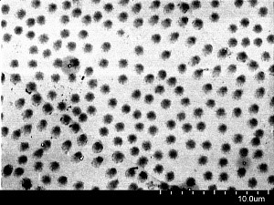 Микрогели. Снимок сделан Еленой Кожуновой при помощи электронного микроскопа. 